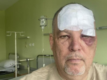 Общински съветник от Бургас е с насинено око и е настанен в болница