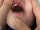 Родител от Пловдив: Заварихме детето със счупен зъб и разбита уста в детс...