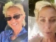 Нана продължава да се бори със сериозните поражения по лицето си