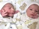 Близнаците Константин и Елена се родиха в Пловдив