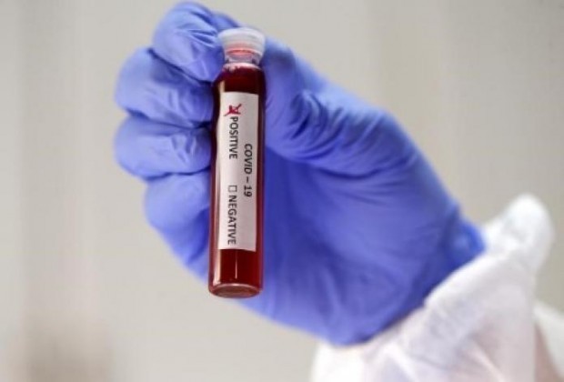 Само 27 са новите случаи на заразени с коронавирус в България