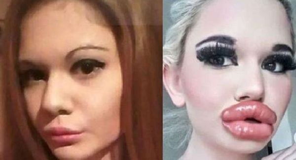 21 ва операция на устните си направи българското Барби Андреа Иванова Блондинката