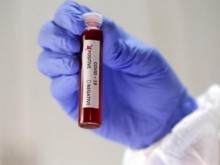 86 са новите случаи на COVID-19 за денонощието, излекуваните са 48