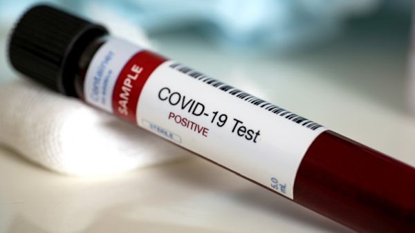 Getty Images
290 са новодиагностицираните с коронавирусна инфекция лица през изминалите