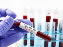 Заразата пълзи! Нови 240 случая на Covid-19