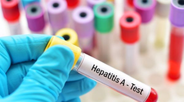 Епидемичен взрив на хепатит А е регистриран в луковитското село