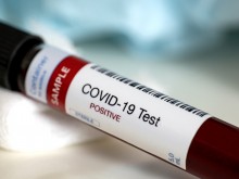 СЗО: "Ремдесевир" не помага при COVID-19
