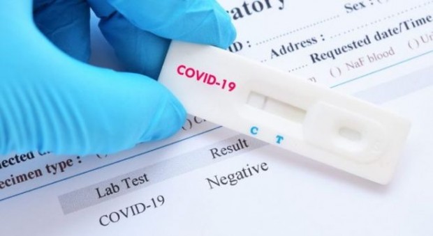 327 са новодиагностицираните с коронавирусна инфекция лица през изминалите 24