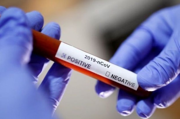 3754 са новоустановените случаи на коронавирус при направени 11 131 теста за