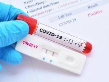 Нов странен симптом на COVID-19, който се проявява само у по-младите