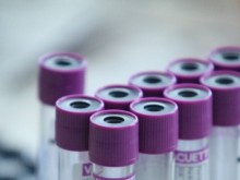 За последните 24 часа: 36.2% от тестваните са положителни
