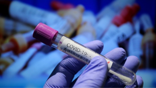 2814 са новите случаи на заразени с коронавирус в България за