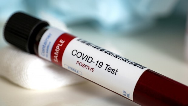 Новите случаи на коронавирус в България са 1 739 за