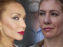 Клъцни-срежи нослето! Кои родни звезди се оперираха през 2020?