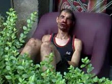 Мъж с размазано от бой лице бе открит тази сутрин в центъра на Пловдив