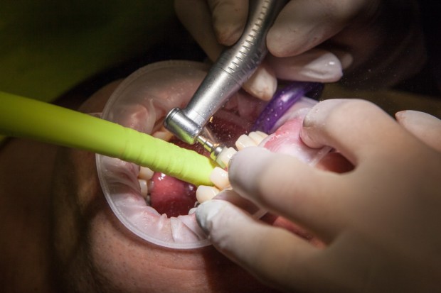 Българските зъболекари още не са получили достъп до списъците със заразените