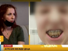 Момче е със счупена челюст след спречкване заради бутнато колело