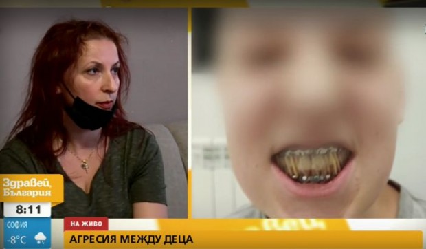 13 годишно дете от Костенец е със счупена челюст след като