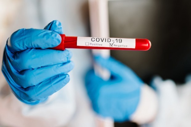 506 са новорегистрираните заразени с коронавирус за последните 24 часа