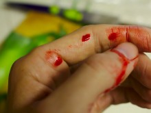 Двама пребиха мъж по пътя Суворово - Девня