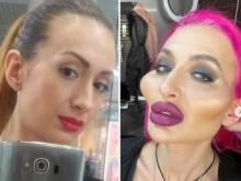 Жената с най-нечовешкото лице на света показа как е изглеждала преди