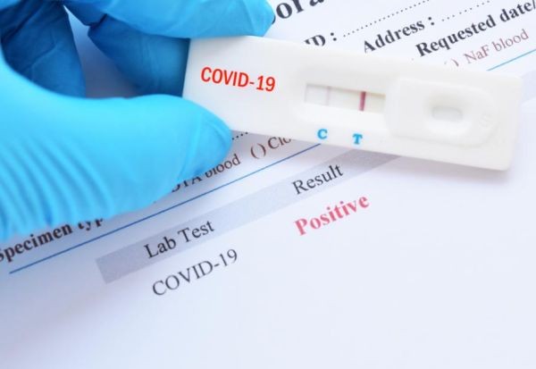 1426 са новите заразени с коронавирус у нас, при направени