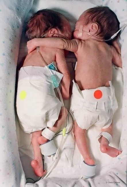 Когато през 1995 а близначките Бриел и Кайли Джаксън се раждат