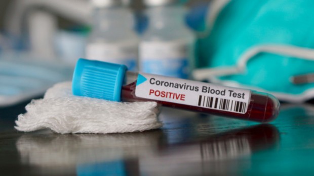 506 са новодиагностицираните с коронавирусна инфекция през изминалите 24 часа