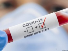 Медици: Прекаралите лека форма на COVID-19 имат имунитет за цял живот