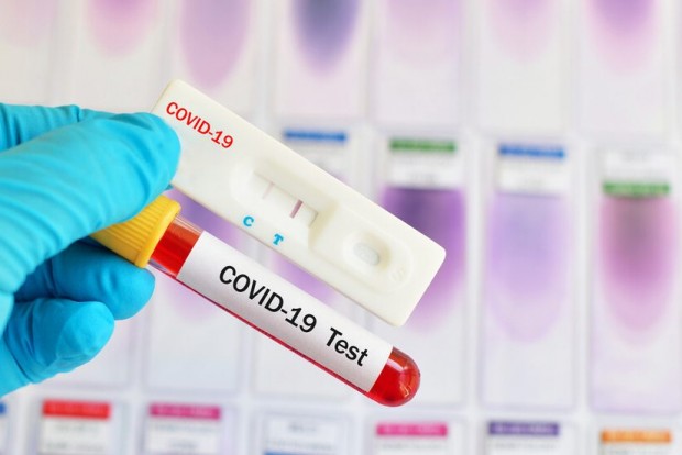 Общо 115 нови случая на заразяване с коронавирус за последните