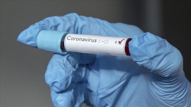 53 са новите случаи на заразени с коронавирус у нас през последното