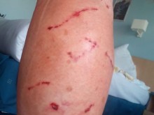 Жена изживя неописуем ужас, докато се разхожда по алея в "Златни пясъци"