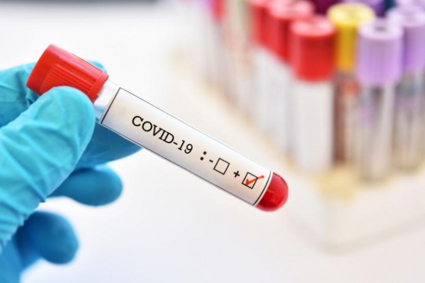161 са новите случаи на коронавирус у нас или малко