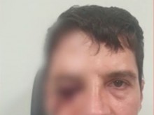 Пребиха мъж с чукове посред бял ден