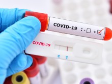 Само 0.8% от тестовете за COVID-19 са положителни