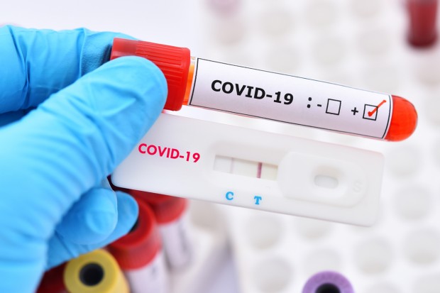 94 нови случая на коронавирус у нас през изминалото денонощие