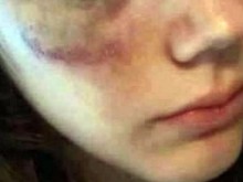 Агресивен бизнесмен нападна момиче с кожен колан
