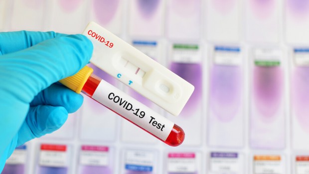 iStock
Ваксинираните срещу COVID 19 не са освободени от тест при пътуване