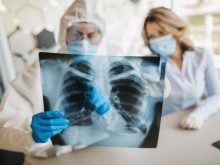 Министерството на здравеопазването с уточнение