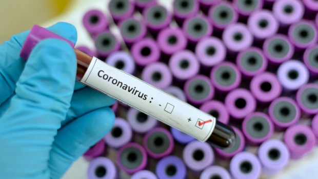 iStock
Новите случаи на коронавирус у нас са 346. Това показват