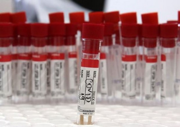 През изминалото денонощие в страната са установени 182 нови случая на коронавирусна