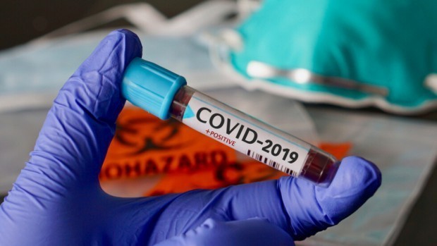 805 души са новозаразените с коронавирус от вторник - с