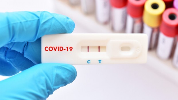 451 са новодиагностицираните с COVID 19 лица у нас за изминалите