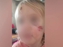След набити спирачки: Дете изхвърча от ръцете на майка си и пострада жестоко в такси