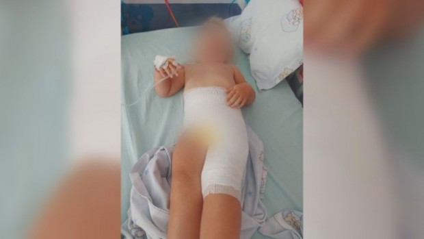 БТВ
2 годишно дете получи химическо изгаряне и бе прието по спешност