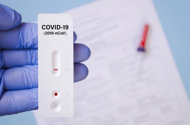 Единадесет антигенни теста за диагностициране на COVID-19, налични на пазара