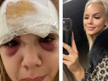Красивата Славея след тежко ПТП: Умирам от болка всеки ден, но съм щастлива!
