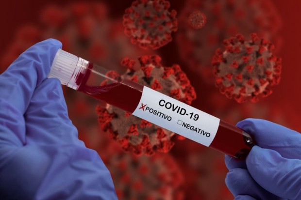 profimedia
Екип от изследователи в Израел откри протеини в COVID-19, които
