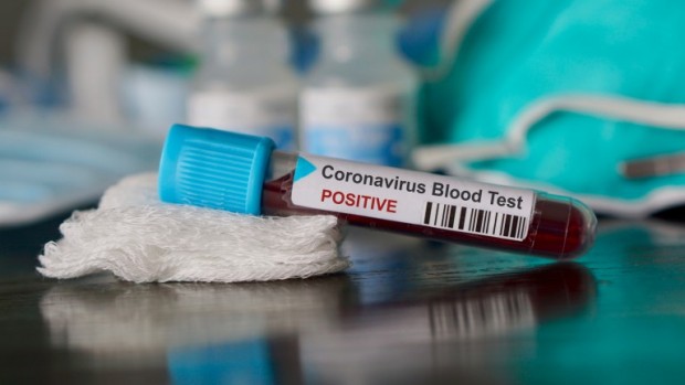 iStock
Новите случаи на коронавирус у нас през изминалото денонощие са