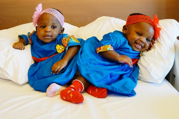16 месечните сиамски близнаци Елизабет и Мери от Камерун бяха изписани